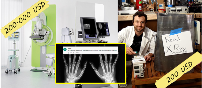 Anh chàng bức xúc về nhà đăng lên YouTube tuyên bố tự tay lắp máy X-quang tại nhà và kết quả bất ngờ sau khi phải trả gần 1,6 tỷ đồng tiền viện phí.