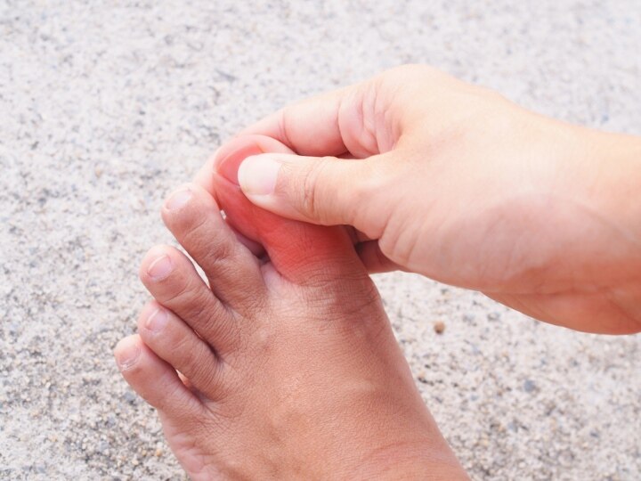 Một số bệnh lý bạn cần nghĩ ngay đến khi bị tê đầu ngón chân cái kéo dài
