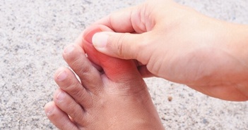 Một số bệnh lý bạn cần nghĩ ngay đến khi bị tê đầu ngón chân cái kéo dài
