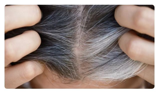 3 loại phụ liệu thực phẩm hỗ trợ ngăn ngừa tóc bạc sớm rụng