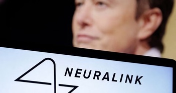 Chip cấy não của Elon Musk sắp được thử nghiệm trên người.