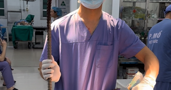 Cứu sống một thanh niên bị thanh xà beng dài 90cm đâm xuyên cổ Cứu sống một thanh niên bị thanh xà beng dài 90cm đâm xuyên cổ