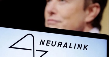 Công ty của tỷ phú Elon Musk được phép thử cấy chip vào não người