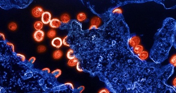 Các nhà khoa học phát hiện ra một tập hợp biến thể di truyền dường như có thể hạn chế lây nhiễm HIV