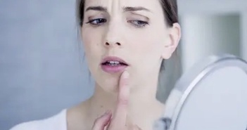 Một số thực phẩm và biện pháp giúp khắc phục vết loét miệng tại nhà hiệu quả Một số thực phẩm và biện pháp giúp khắc phục vết loét miệng tại nhà hiệu quả
