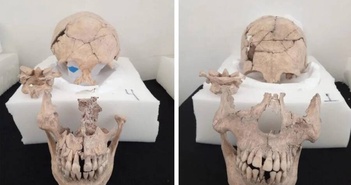 Các nhà khảo cổ ở Mexico phát hiện 13 hộp sọ bí ẩn dưới chân kim tự tháp Maya Các nhà khảo cổ ở Mexico phát hiện 13 hộp sọ bí ẩn dưới chân kim tự tháp Maya