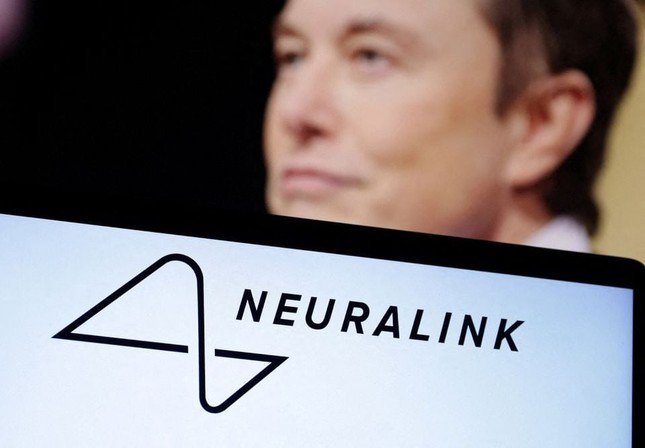Công ty của tỷ phú Elon Musk lần đầu tiên cấy chip vào não người