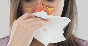 5 loại thực phẩm giúp giảm đau khi bị viêm xoang 5 loại thực phẩm giúp giảm đau khi bị viêm xoang