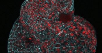 Nghiên cứu tạo 'lá phổi mini' từ tế bào nước ối