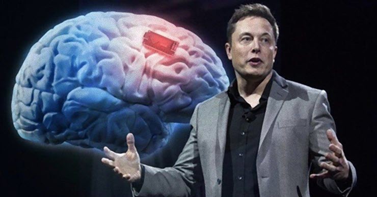 Chip cấy não đầu tiên của Elon Musk bất ngờ gặp trục trặc