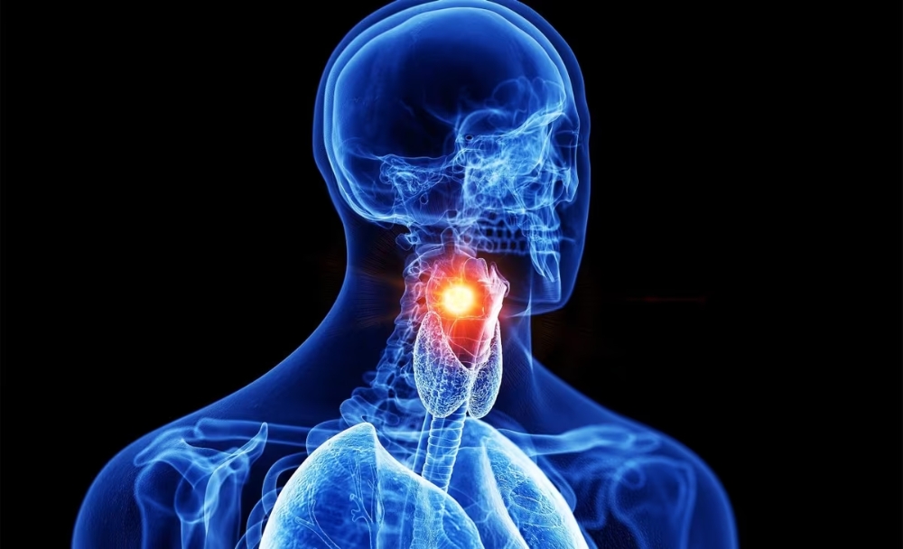 AI giúp chẩn đoán ung thư thanh quản chỉ bằng giọng nói