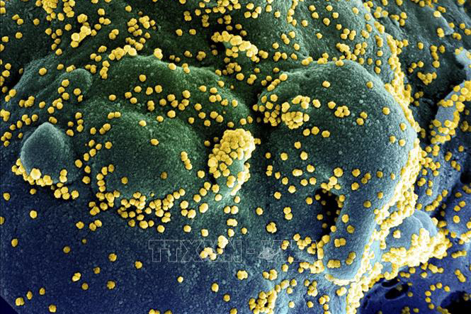 Nghiên cứu mới: Hoạt chất chiết xuất từ tinh dầu khuynh diệp có thể tiêu diệt virus SARS-CoV-2