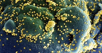Nghiên cứu mới: Hoạt chất chiết xuất từ tinh dầu khuynh diệp có thể tiêu diệt virus SARS-CoV-2 Nghiên cứu mới: Hoạt chất chiết xuất từ tinh dầu khuynh diệp có thể tiêu diệt virus SARS-CoV-2