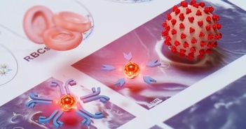 Xét nghiệm 'nano vàng' giá rẻ giúp phát hiện bệnh chết người qua một giọt máu Xét nghiệm 'nano vàng' giá rẻ giúp phát hiện bệnh chết người qua một giọt máu