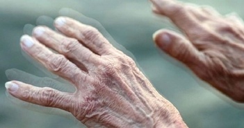 Lần đầu quan sát được 'mồi lửa' khởi phát bệnh Parkinson Lần đầu quan sát được 'mồi lửa' khởi phát bệnh Parkinson