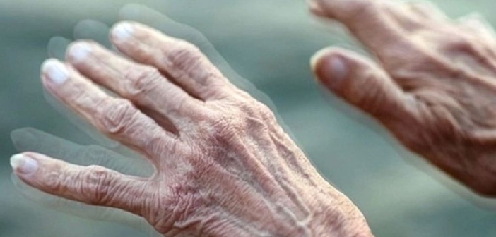 Lần đầu quan sát được 'mồi lửa' khởi phát bệnh Parkinson