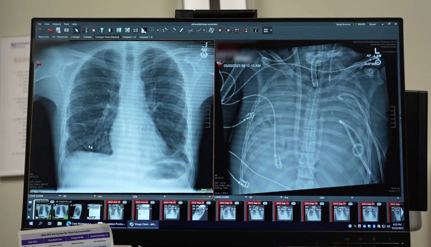 Đột phá phổi nhân tạo cứu sống bệnh nhân chờ ghép tạng