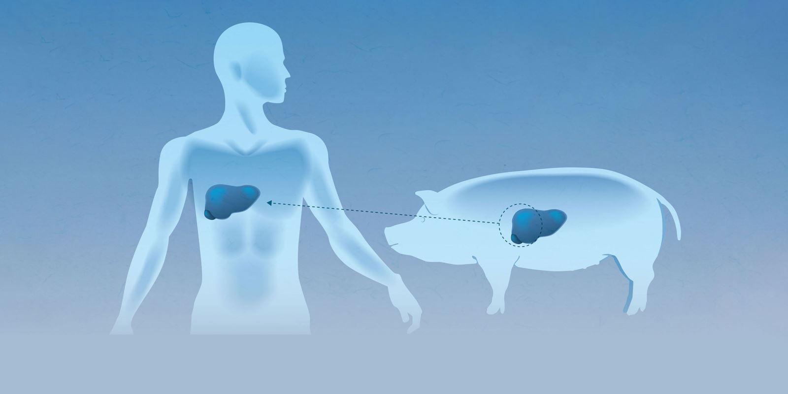 Trung Quốc mở hướng mới điều trị suy gan bằng gan lợn