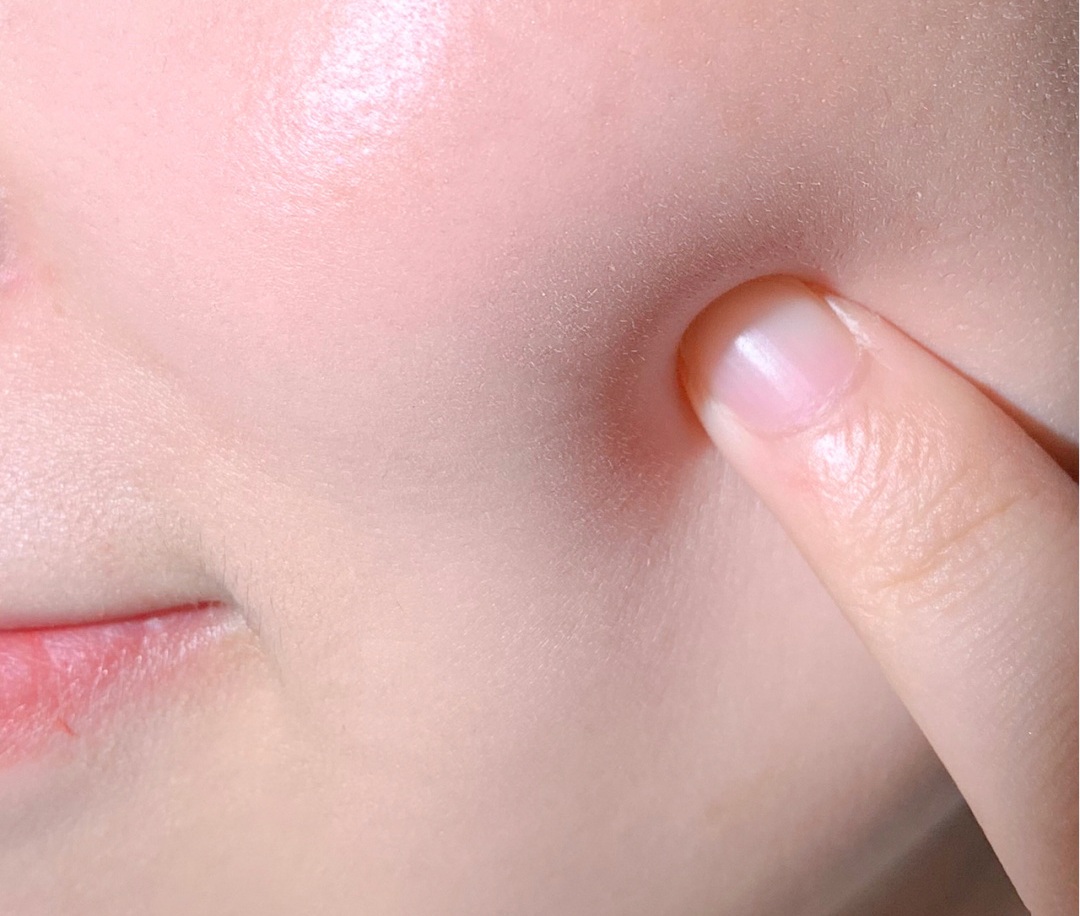 Giải pháp giúp kéo dài tuổi thọ làn da