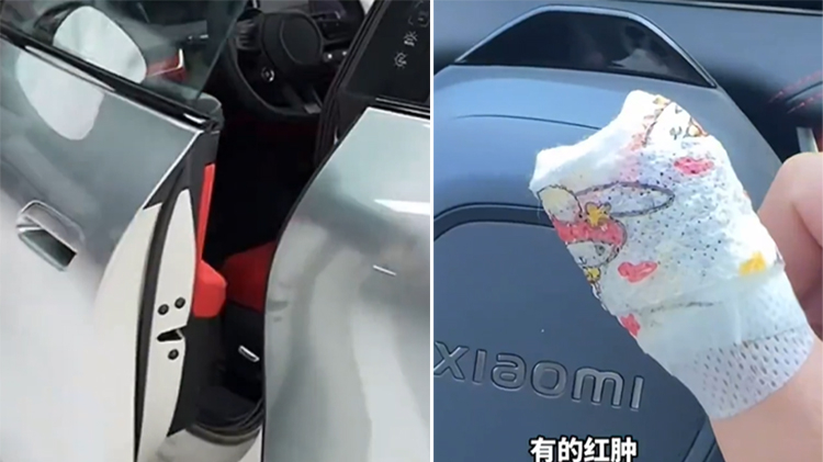 Chủ xe Xiaomi bị cửa kẹp gãy tay, hãng đền bằng điểm ứng dụng