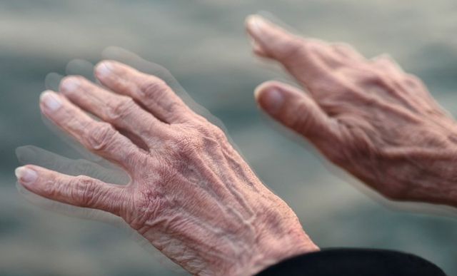 Triển vọng theo dõi Parkinson và các rối loạn thần kinh bằng phương pháp không xâm lấn